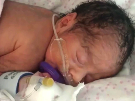 Newborn in incubator with IV and nose breathing tube