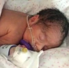 Newborn in incubator with IV and nose breathing tube